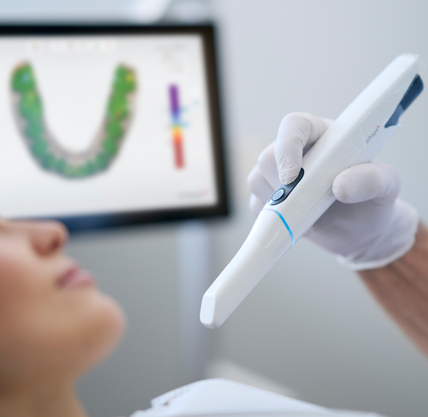 What is digital oral scanning?